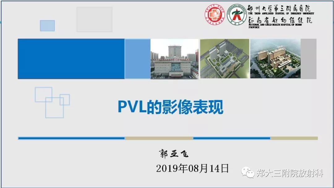 PVL脑室周围白质软化症的影像表现