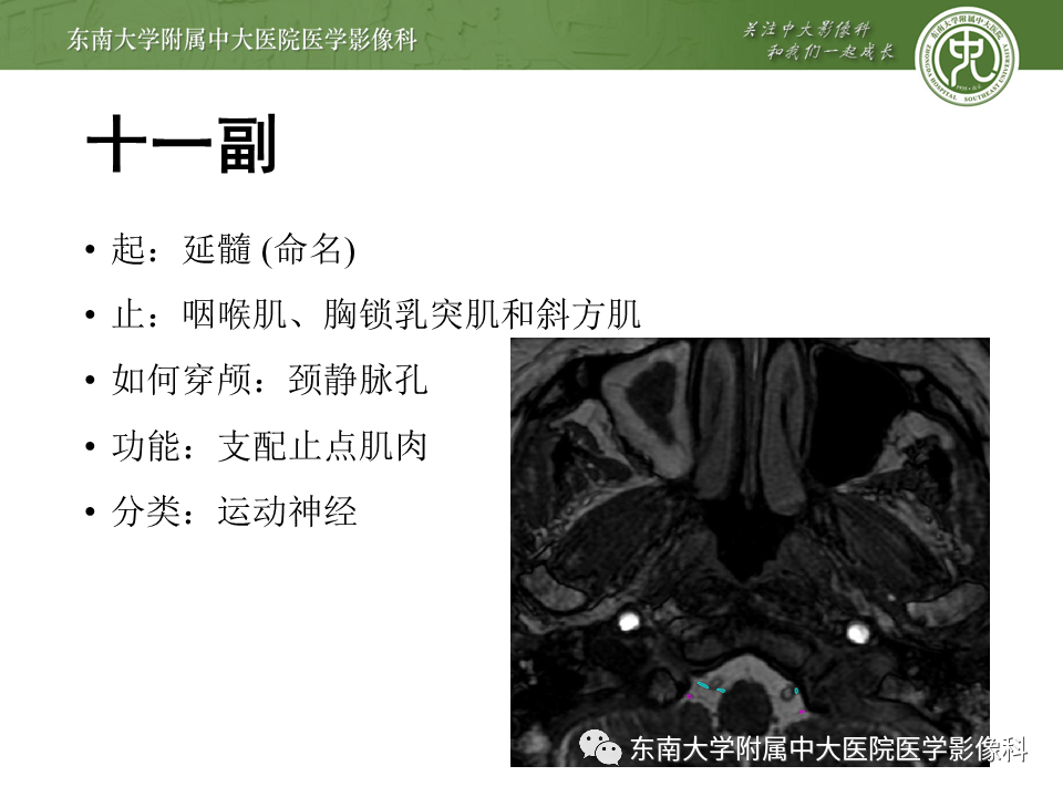【PPT】颅神经原发肿瘤