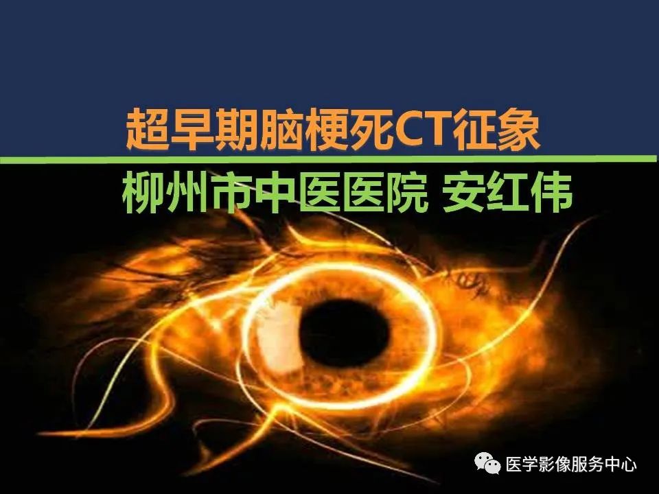 超早期脑梗死CT征象
