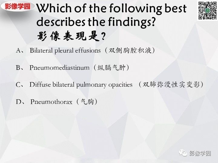 【双语病例】肺泡蛋白沉积症PAP一例CT