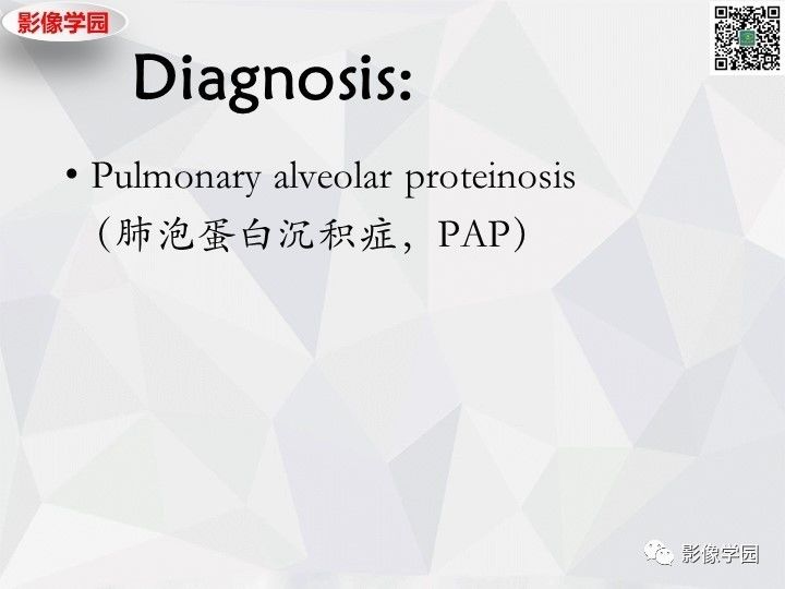 【双语病例】肺泡蛋白沉积症PAP一例CT