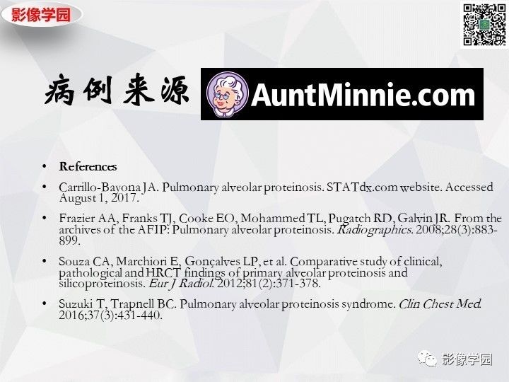 【双语病例】肺泡蛋白沉积症PAP一例CT
