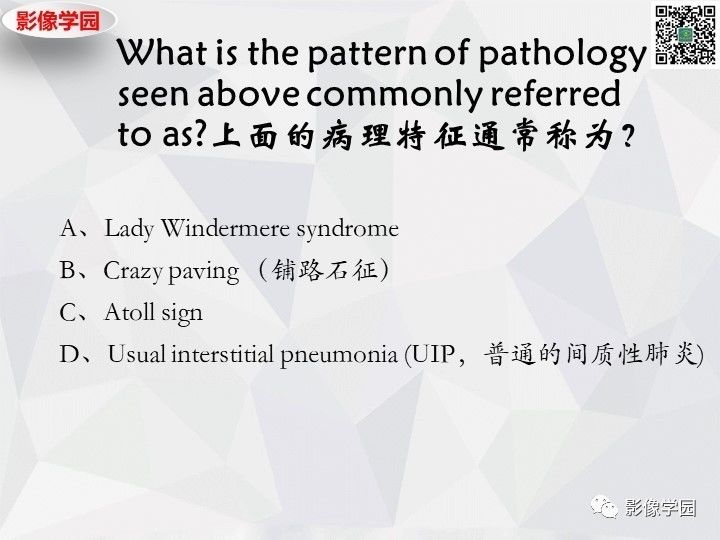 【双语病例】肺泡蛋白沉积症PAP一例CT