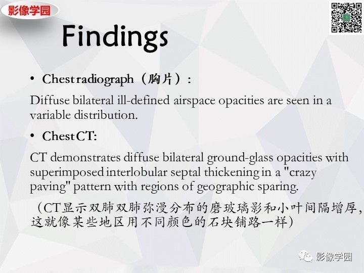 【双语病例】肺泡蛋白沉积症PAP一例CT
