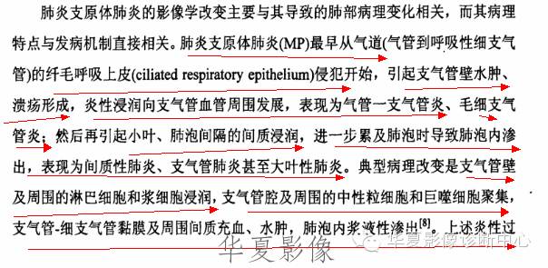 【病例】支原体肺炎1例CT影像表现