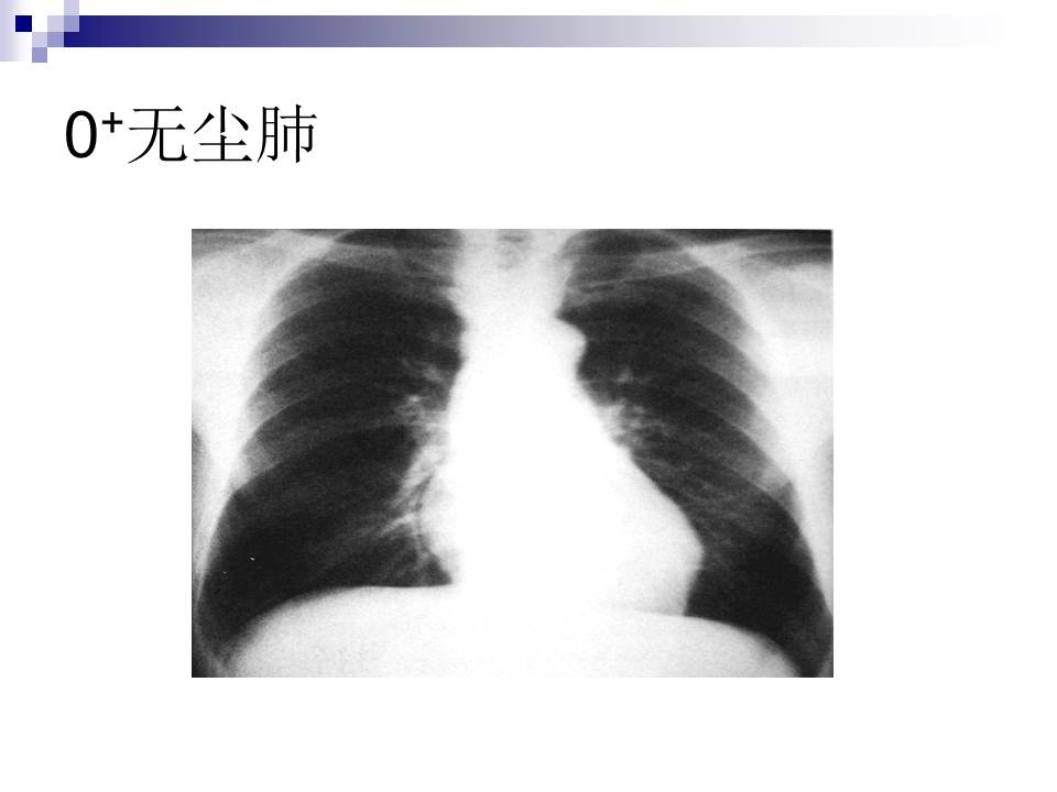 幻灯片26