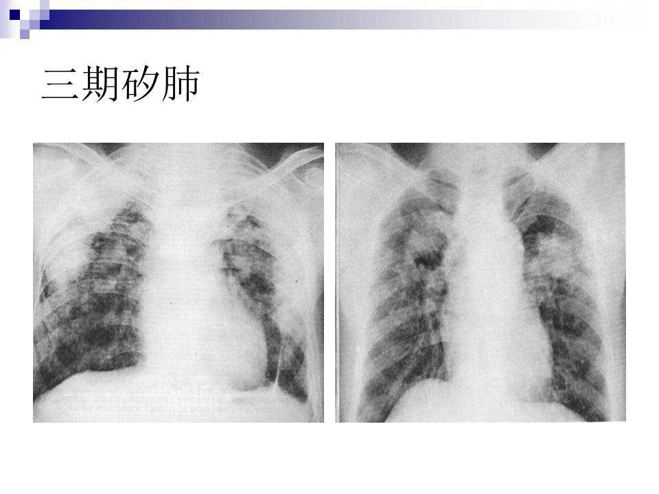 幻灯片30