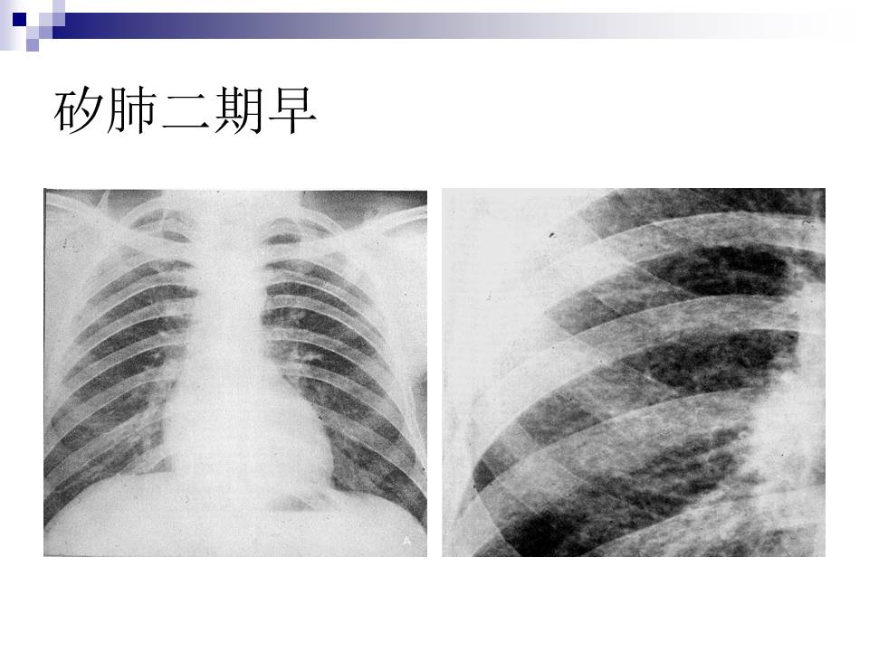 幻灯片28