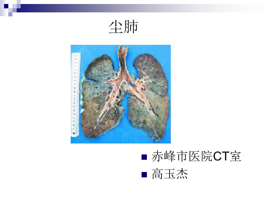 尘肺