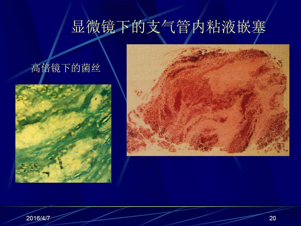 幻灯片20