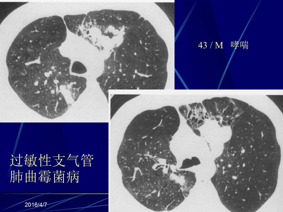 幻灯片18