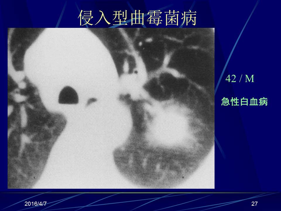 幻灯片27
