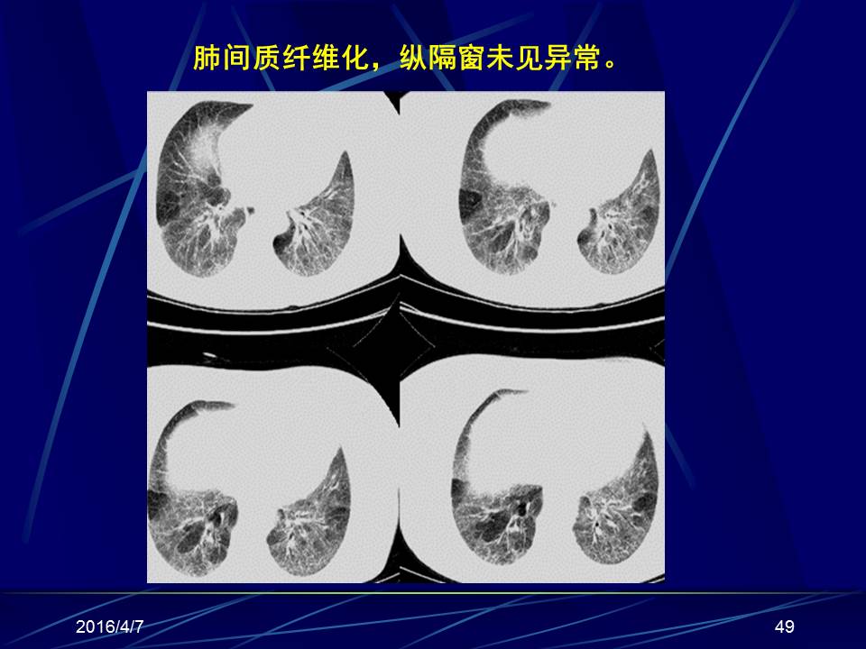 幻灯片49