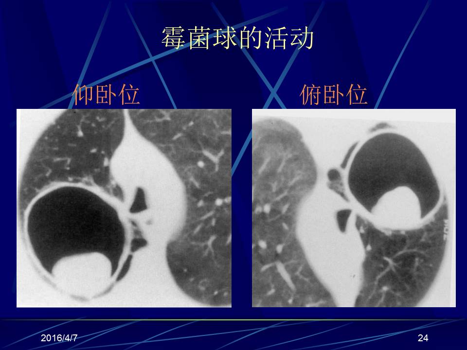 幻灯片24