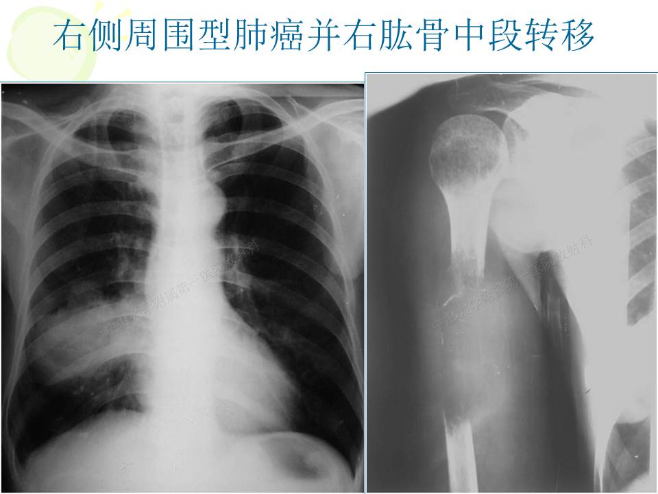 幻灯片47