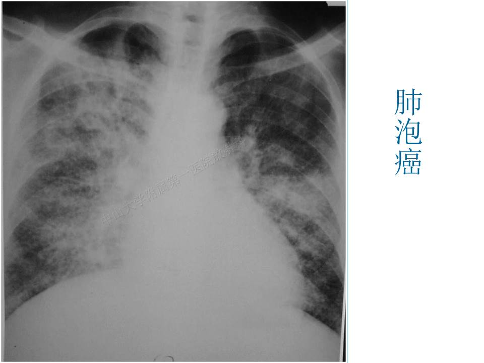 幻灯片42
