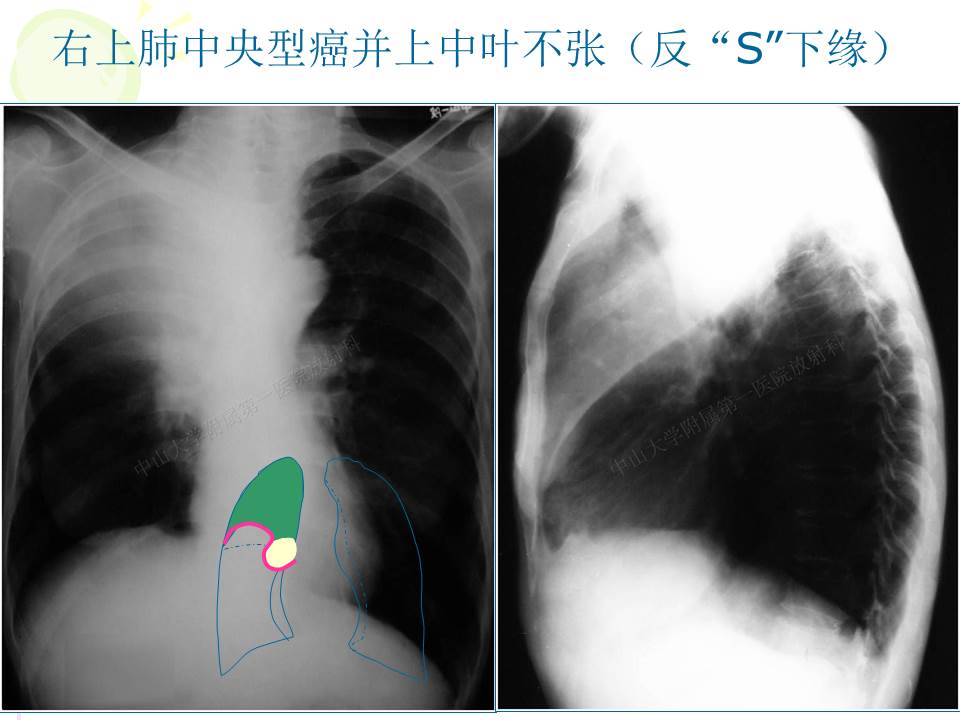 幻灯片14