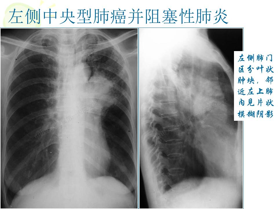 幻灯片18