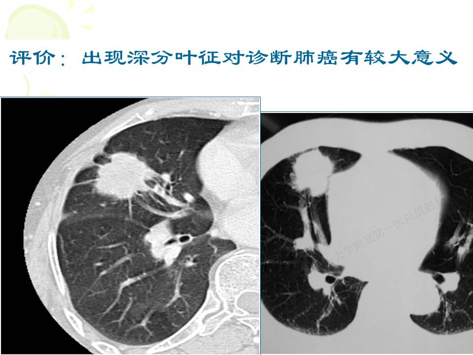 幻灯片31