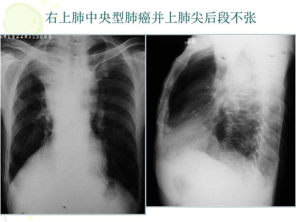 幻灯片13