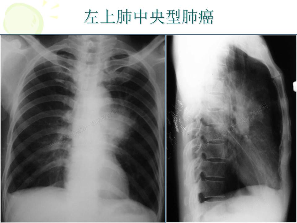 幻灯片15