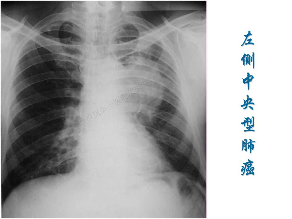 幻灯片16