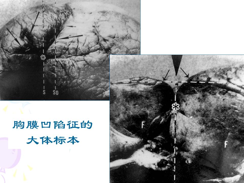 幻灯片30