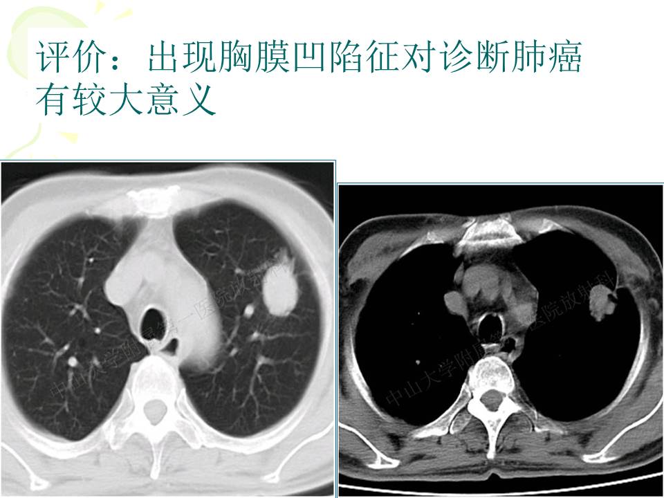 幻灯片29