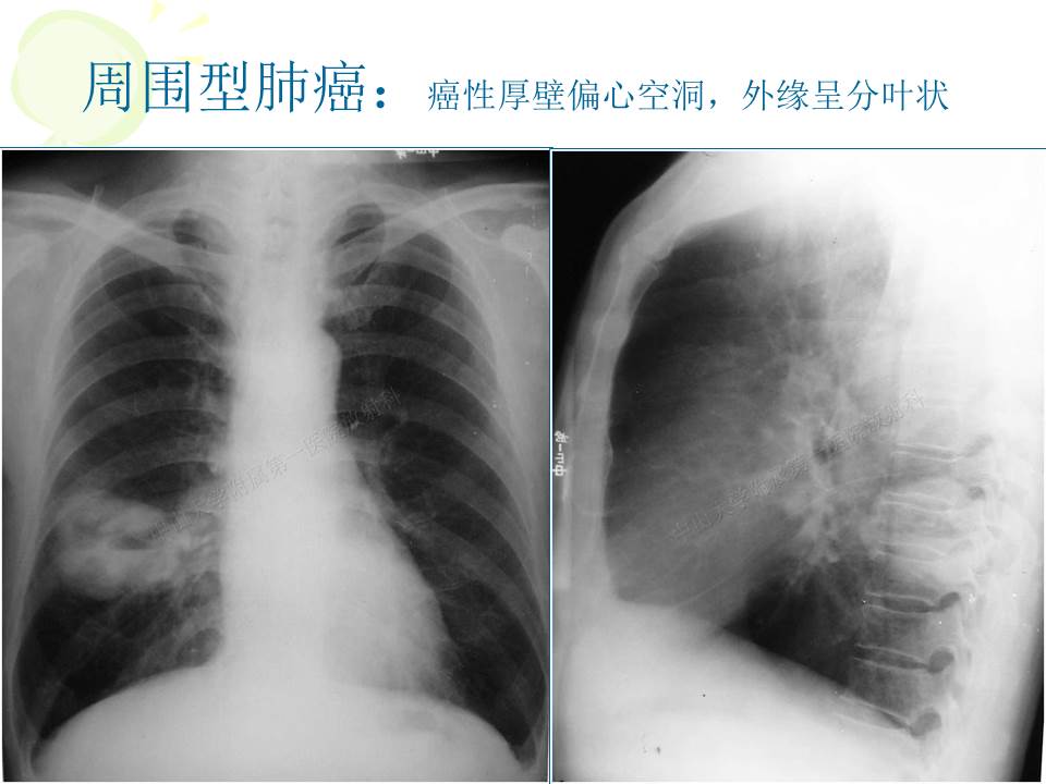 幻灯片25