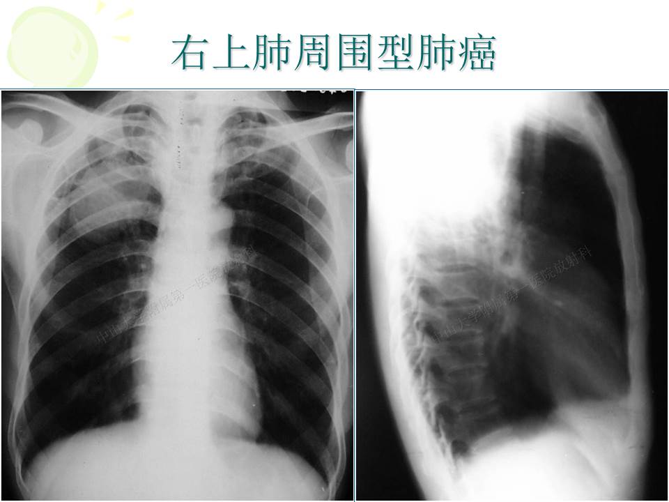 幻灯片23