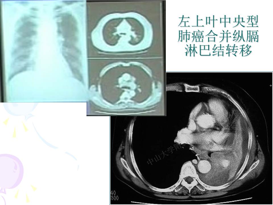 幻灯片20