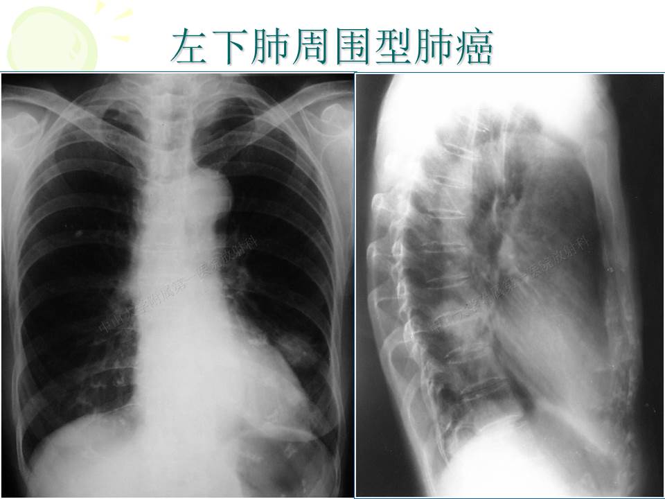 幻灯片24