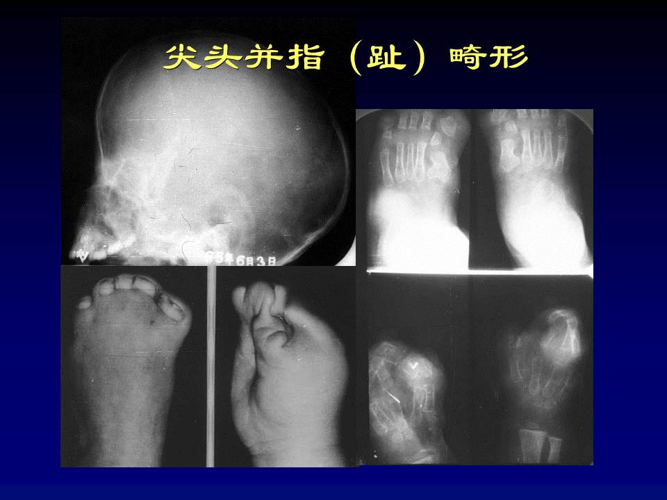 幻灯片12