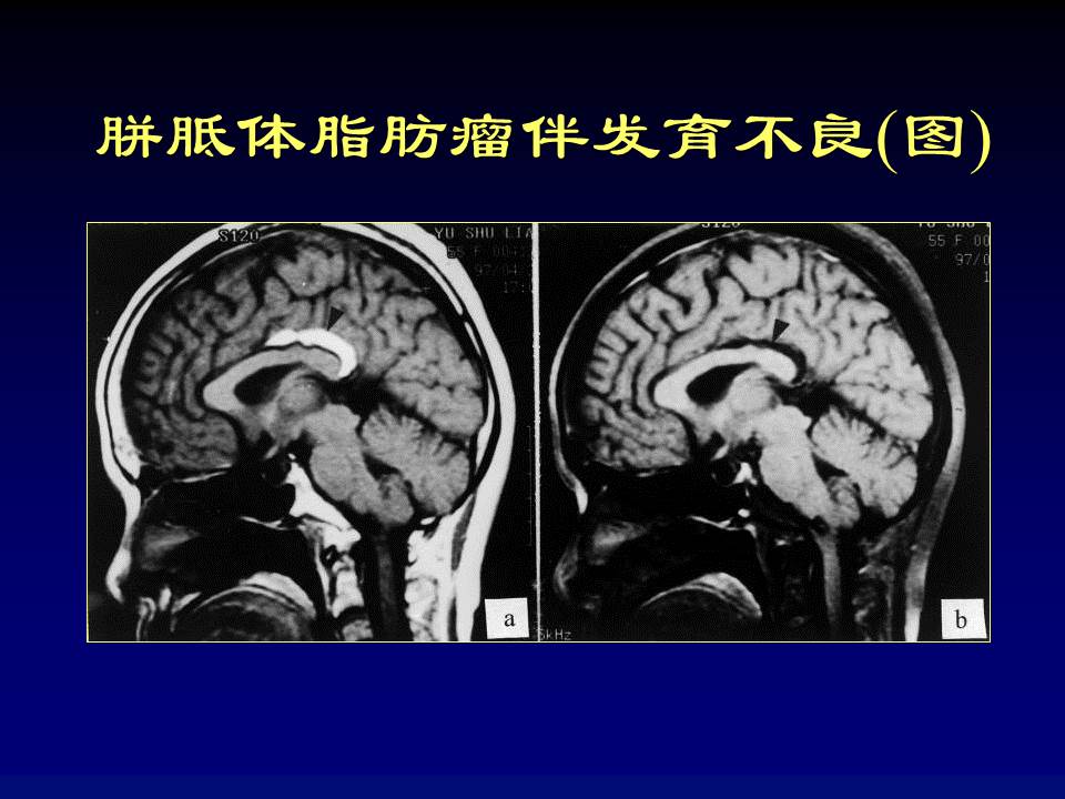 幻灯片29