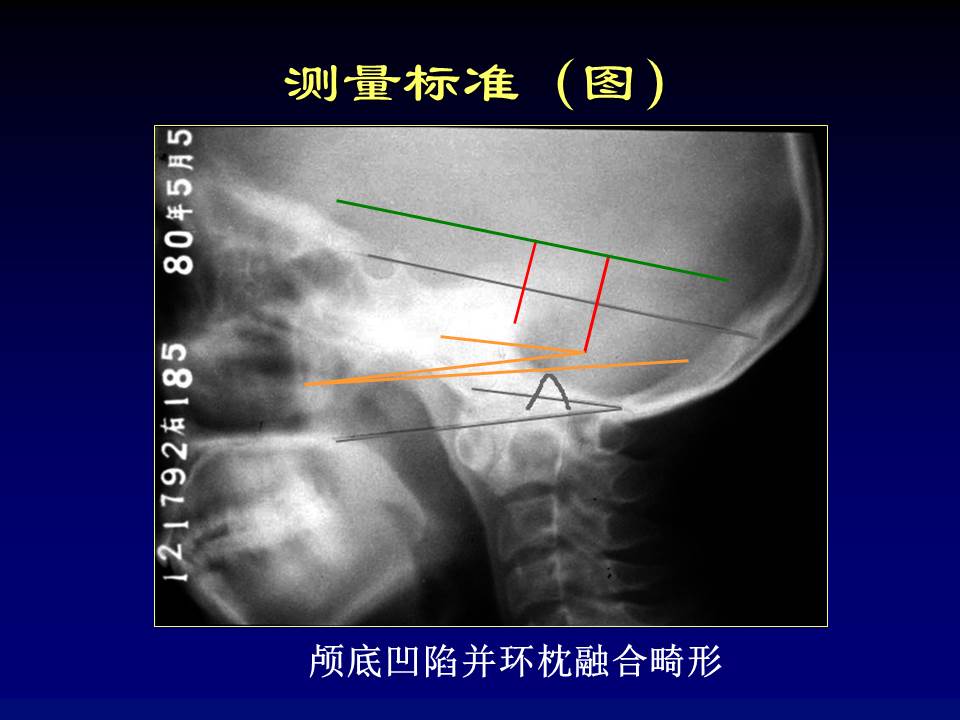 幻灯片15