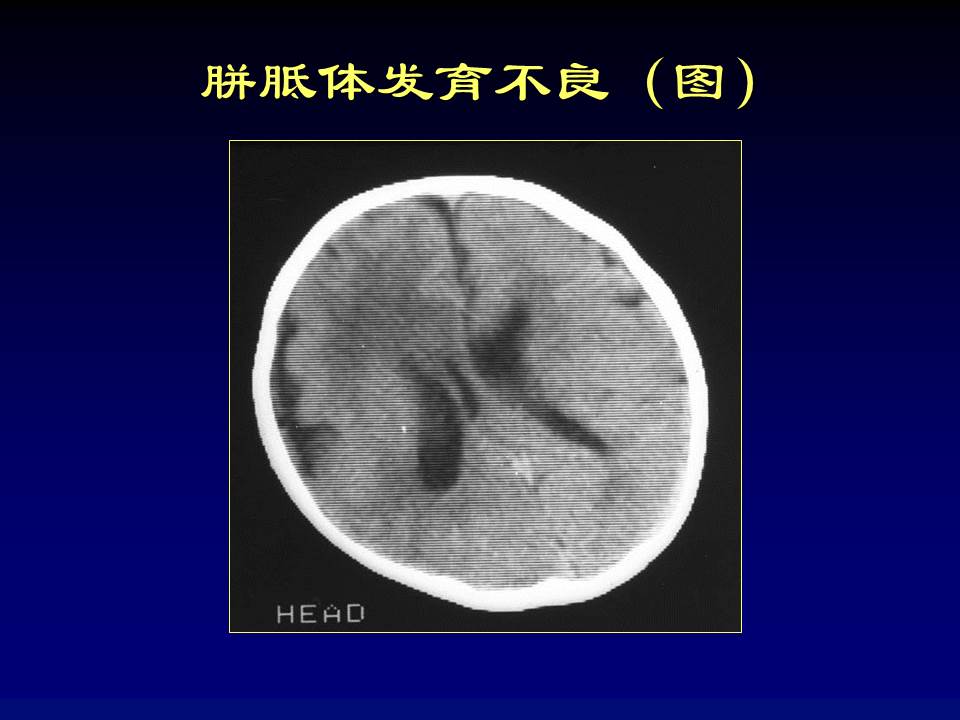 幻灯片28