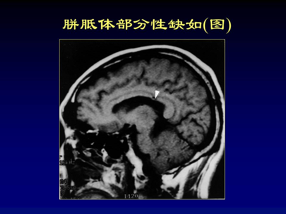 幻灯片30