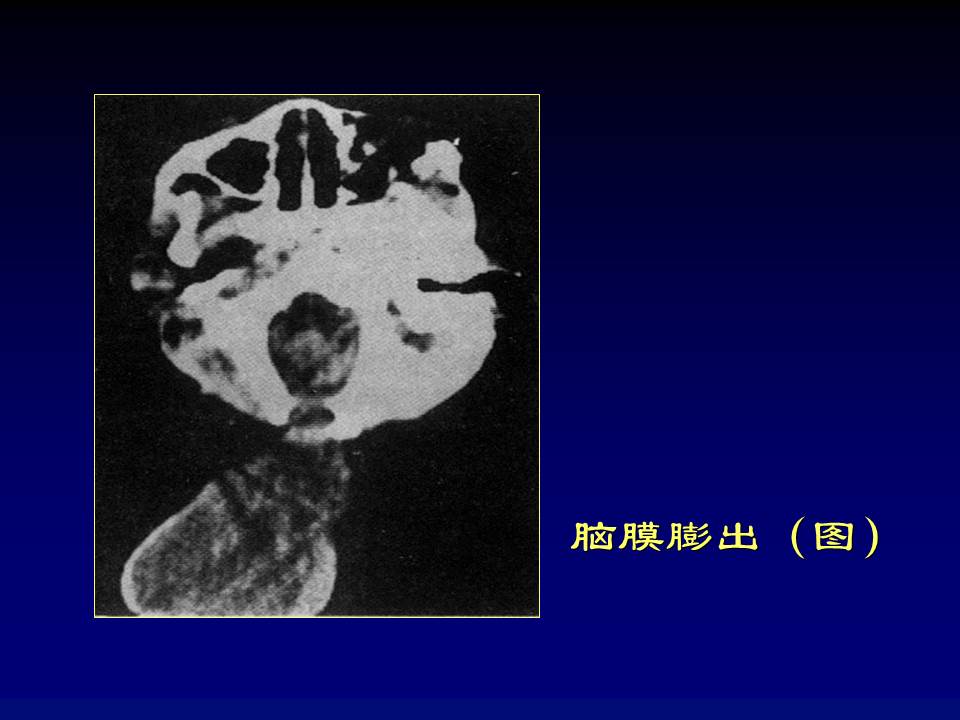 幻灯片22