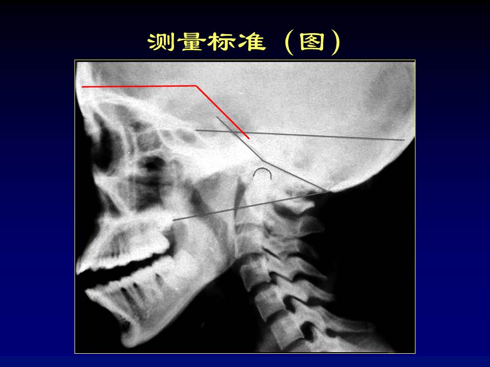 幻灯片16
