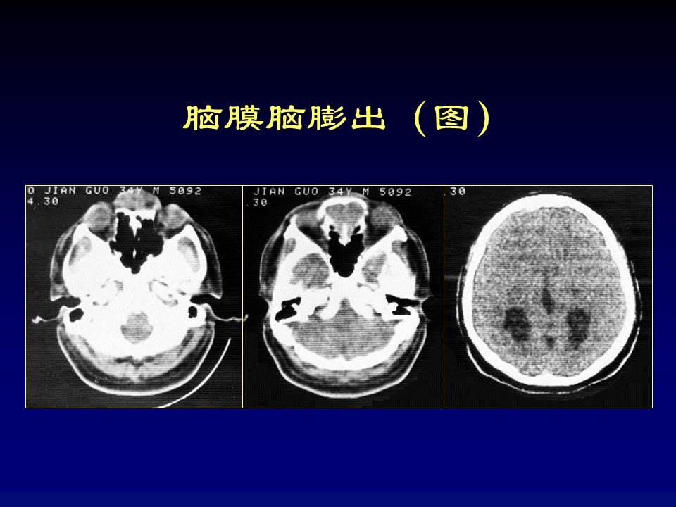 幻灯片23