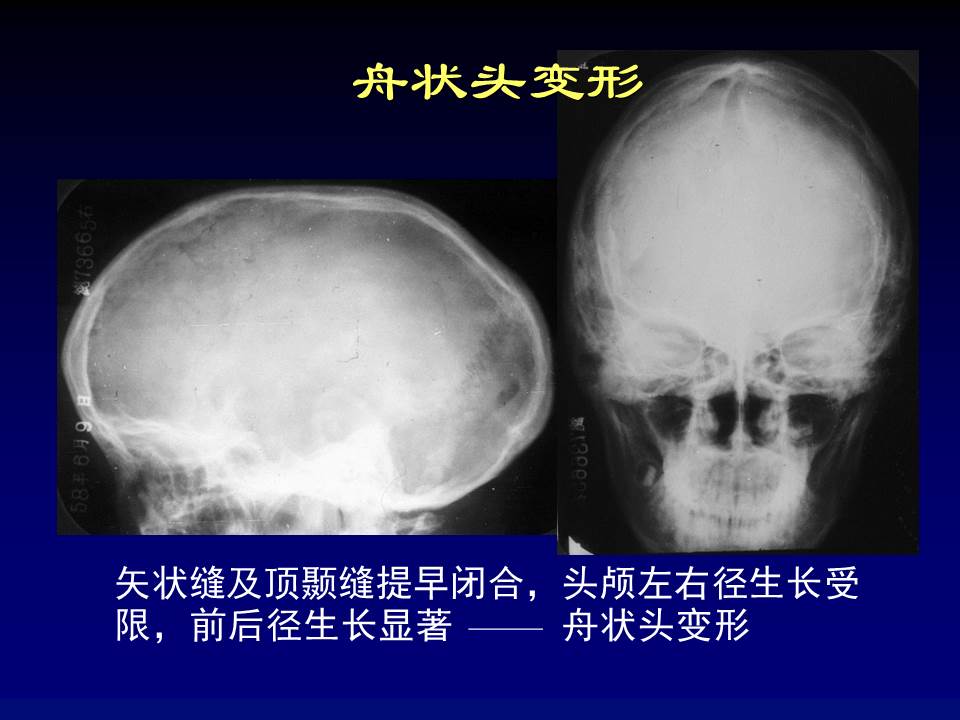 幻灯片9