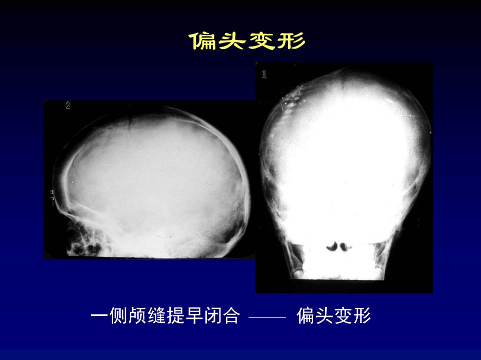 幻灯片10