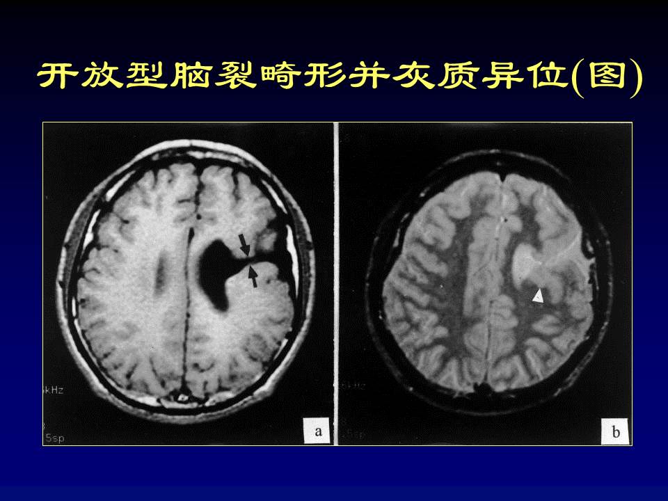 幻灯片53