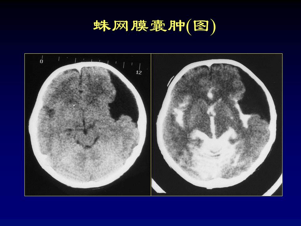幻灯片71