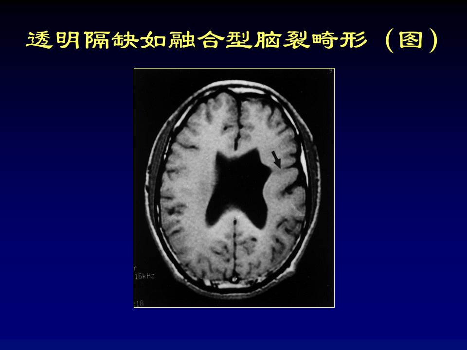 幻灯片52