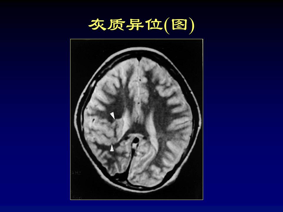 幻灯片47