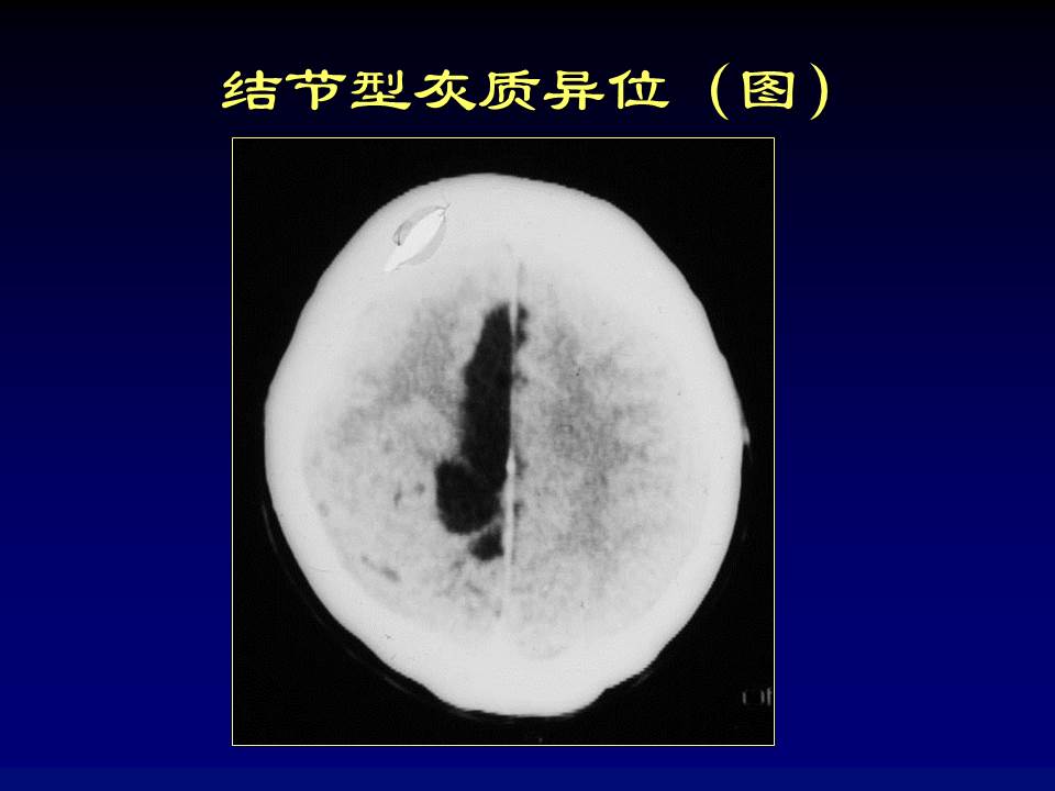 幻灯片45