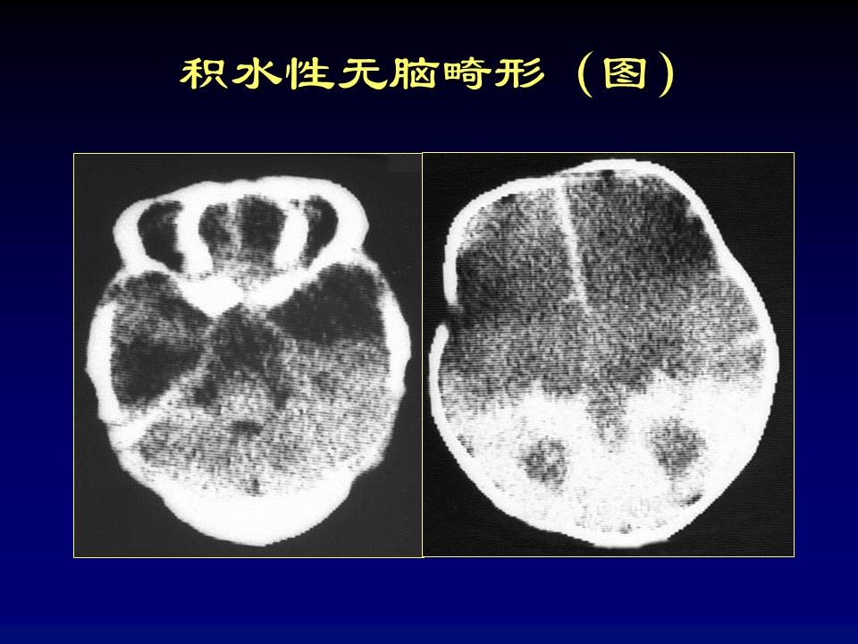 幻灯片65