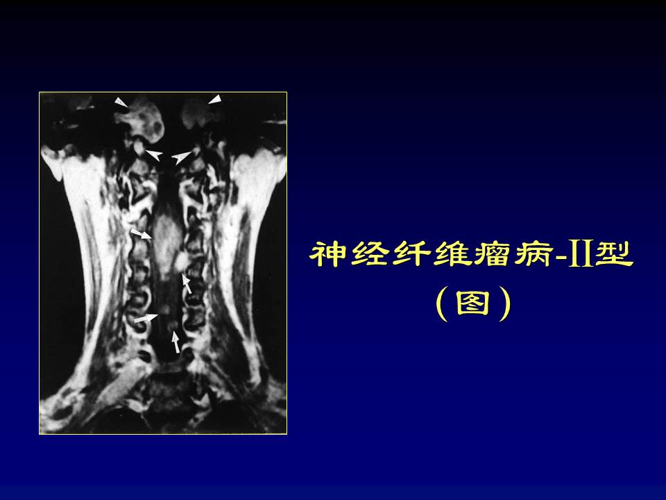 幻灯片86