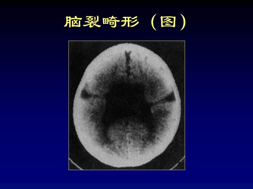 幻灯片54